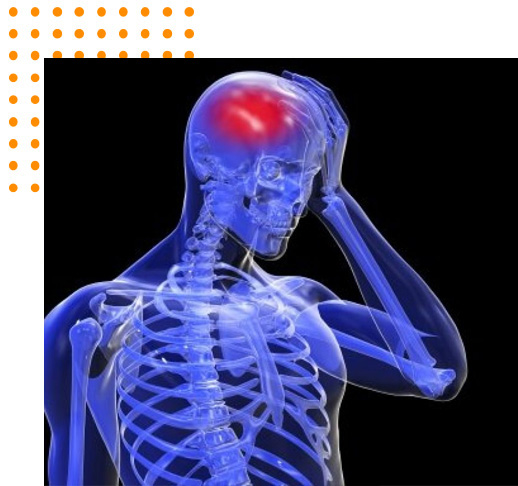 Craniotomy for Cerebral Stroke Craniotomy for Cerebral Stroke
