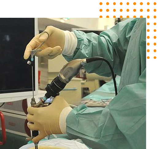 Before Getting Endoscopic Procedures Before Getting Endoscopic Procedures
