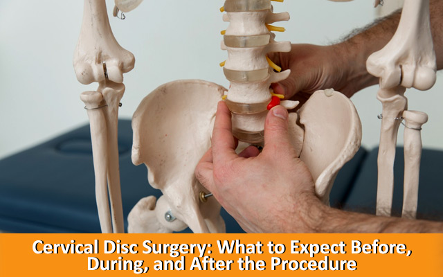 Cervical Disc Surgery: What to Expect Before, During, and After the Procedure
