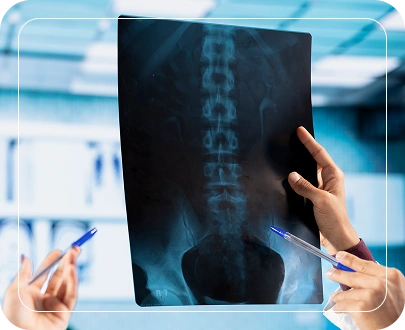 For Cervical Spine For Cervical Spine