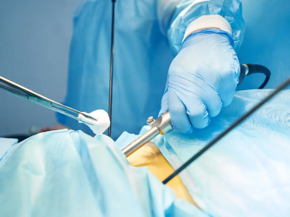Minimally Invasive Spine Surgery for treatmenta<br />
