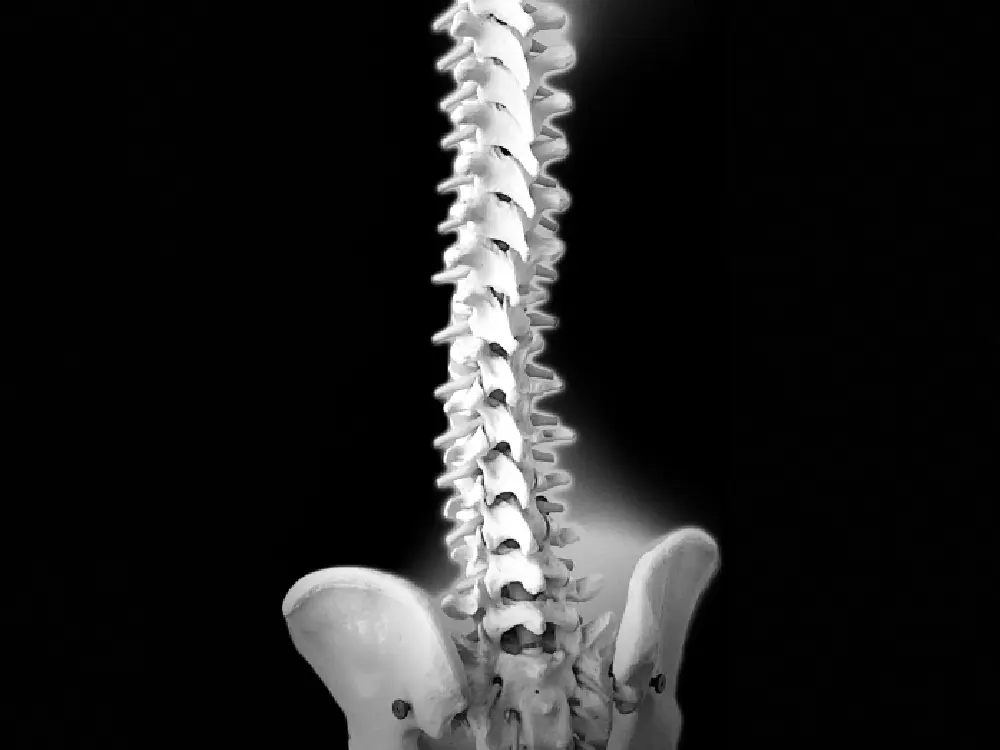 Spine Degeneration for treatment<br />
