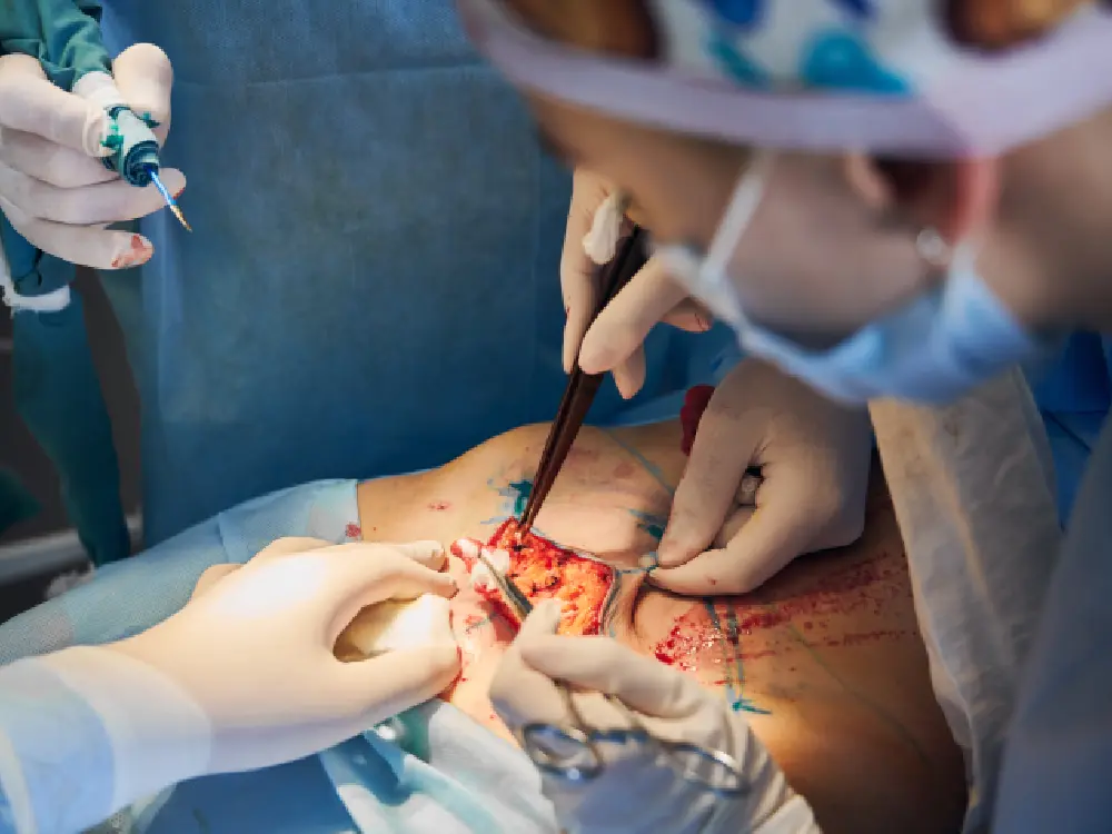 Transsphenoidal Surgery for treatment
