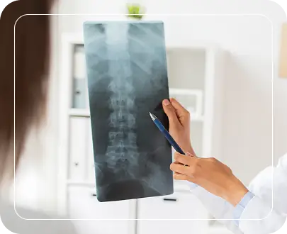 Types of Spine Lumbar Scoliosis-img Types of Spine Lumbar Scoliosis-img