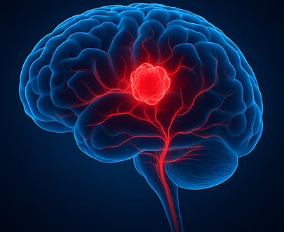 Conditions Treated Through Cranial Surgery | Dr Rohit Mishra