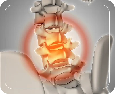 Types of Spine Fractures