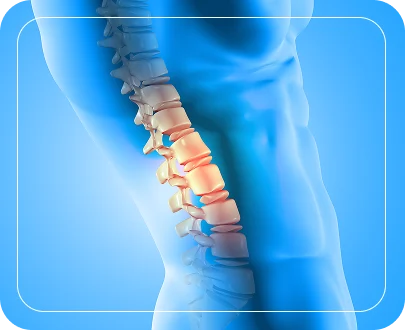 Spine Fractures overview 