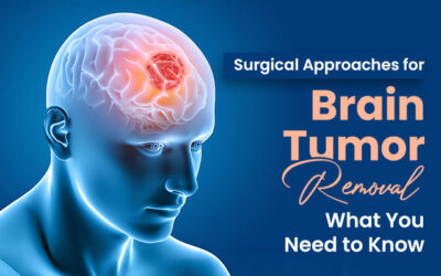 Surgical Approaches for Brain Tumour Removal: What You Need to Know
