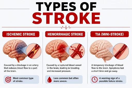Middle-aged man collapsed on the floor holding his head, illustrating sudden stroke onset and emergency situation, emphasizing immediate medical attention for stroke signs