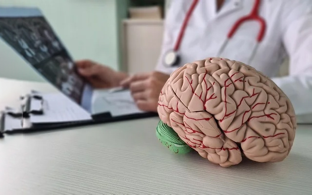 Doctor reviewing brain scan with anatomical brain model during neurological health consultation